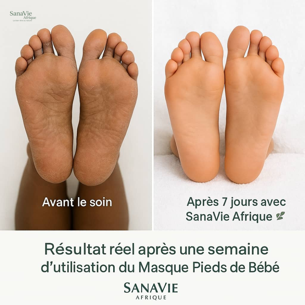 Masque “Pieds de Bébé” SanaVie Afrique